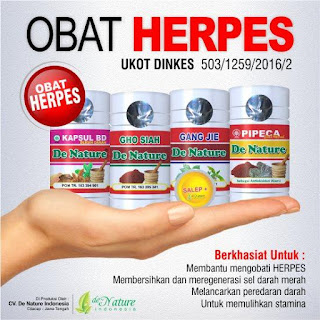 Cara Mengobati Herpes Zoster Secara Alami Tanpa Obat Kimia