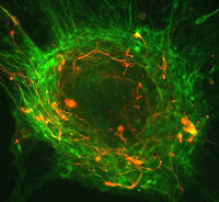 Human embryonic stem cells differentiating into neurons. Photo by the courtesy of CIRM.