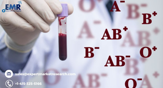Blood Group Typing Market Size and Share Outlook 2022-2027: Industry Growth Analysis, Sales revenue, CAGR Status, Future Demand and Developments