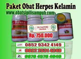 herpes, herpes kelamin, obat herpes, obat herpes kelamin, herpes zoster