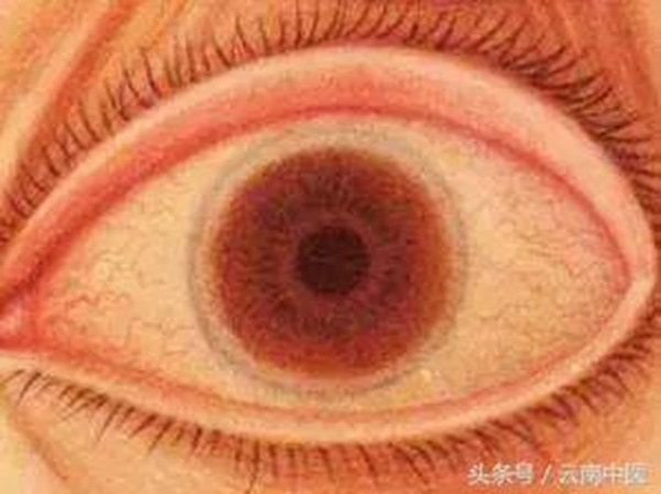 clip_image004