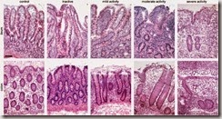 borgarello ibd istologia