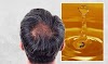 16 benefits of honey that cures hair diseases