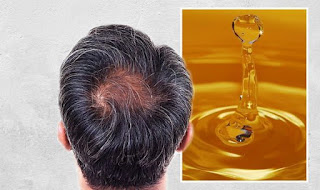 16 benefits of honey that cure hair diseases