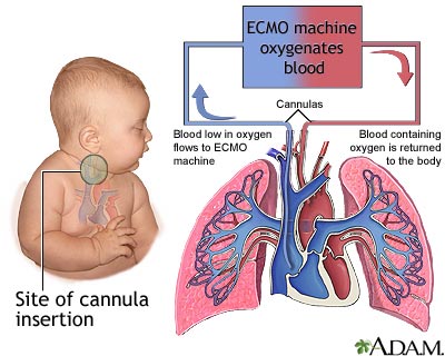  the baby while allowing time for the lungs and heart to "rest" or heal.