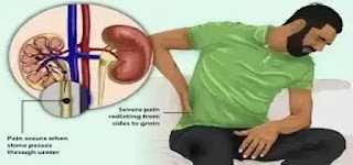 kidney patients