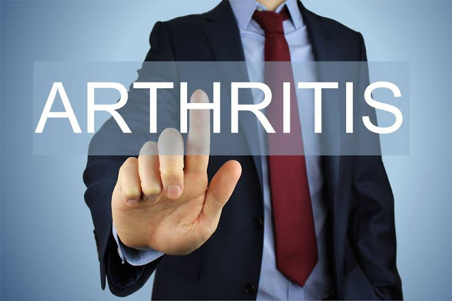 What Should You Know About Arthritis?
