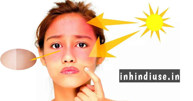 tanning meaning in hindi