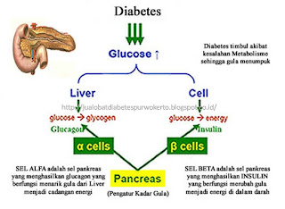Penyebab Penyakit Diabetes