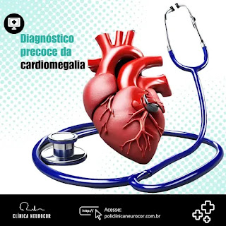 Diagnóstico precoce da cardiomegalia