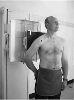 fractured Scapula x-ray