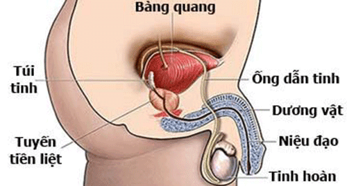 Một vài vấn đề nam khoa cùng với Triệu chứng có thể thấy