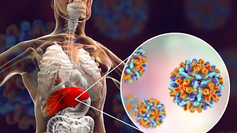 Mengenal Apa Itu Hepatitis A, Penyebab, Gejala, dan Cara Mengatasinya