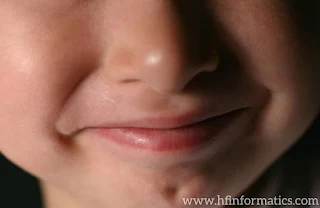 The Cleft Chin: Genetics, Distinctive Feature 2023