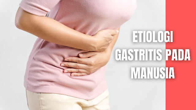 Etiologi Gastritis Pada Manusia Etiologi atau penyebab dari gastritis diantaranya adalah sebagai berikut :  Obat-Obatan Obat-obatan, seperti obat antiinflamasi nonsteroid / OAINS (indometasin, ibuprofen, dan asam salisilat), sulfonamide, steroid, kokain, agen kemoterapi (mitomisin, 5-fluora-2-deoxyuriine), salisilat, dan digitalis bersifat mengiritasi mukosa lambung.    Minuman Beralkohol Minuman beralkohol ; seperti : whisky,vodka, dan gin.    Infeksi Bakteri Infeksi bakteri ; seperti H. pylor (paling sering), H. heilmanii, streptococci, staphylococci, proteus spesies, clostridium spesies, E. coli, tuberculosis, dan secondary syphilis    Infeksi Virus Infeksi virus oleh Sitomegalovirus    Infeksi Jamur Infeksi jamur ; candidiasis, histoplasmosis, dan phycomycosis    Stress Fisik Stress fisik yang disebabkan oleh luka bakar, sepsis, trauma, pembedahan, gagal napas, gagal ginjal, kerusakan susunan saraf pusat, dan refluks ususlambung.    Makanan dan Minuman Yang Bersifat Iritan Makanan dan minuman yang bersifat iritan . makanan berbumbu dan minuman dengan kandungan kafein dan alkohol merupakan agen-agen iritasi mukosa lambung.    Garam Empedu Garam empedu, terjadi pada kondisi refluks garam empedu ( komponen penting alkali untuk aktivasi enzim-enzim gastrointestinal) dari usus kecil ke mukosa lambungsehingga menimbulkan respon peradangan mukosa.    Iskemia Iskemia, hal ini berhubungan dengan akibat penurunan aliran darah ke lambung.    Trauma Langsung Lambung Trauma langsung lambung, berhubungan dengan keseimbangan antara agresi dan mekanisme pertahanan umtuk menjaga integritas mukosa, yang dapat menimbulkan respon peradangan pada mukosa lambung.    Nah itu dia bahasan dari etiologi Gastritis pada manusia, melalui bahasan di atas bisa diketahui mengenai etiologi Gastritis pada manusia. Mungkin hanya itu yang bisa disampaikan di dalam artikel ini, mohon maaf bila terjadi kesalahan di dalam penulisan, dan terimakasih telah membaca artikel ini."God Bless and Protect Us"