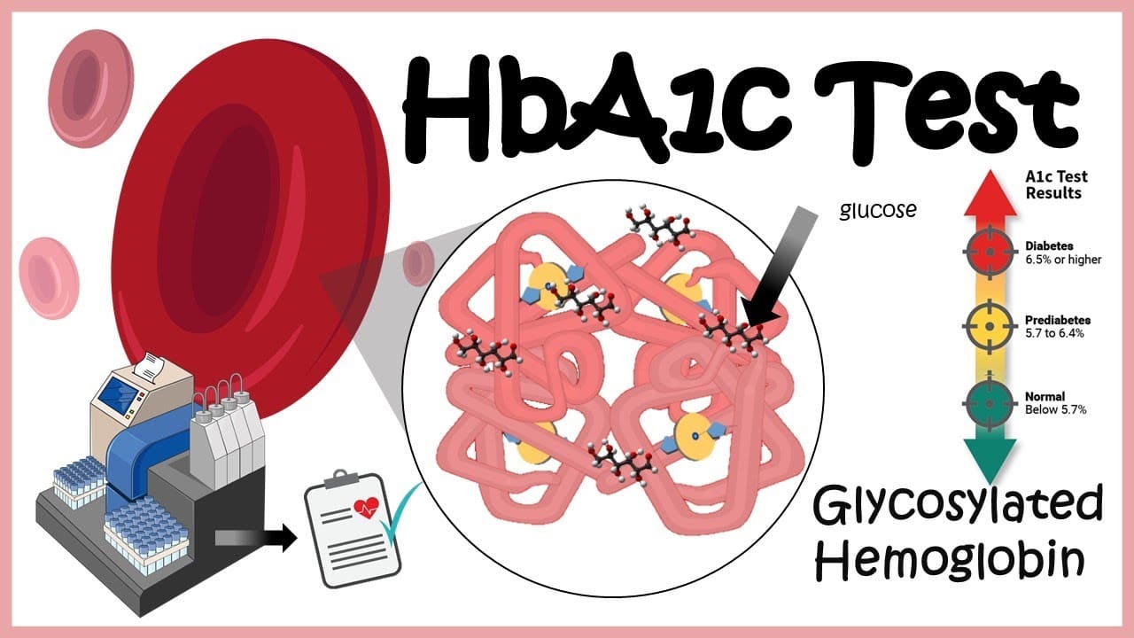 قراءة تحليل السكر التراكمي (HbA1c)