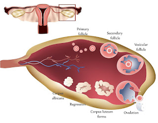 pcos and  pcod