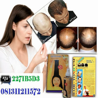 Obat Penumbuh Rambut (Hair tonicum) adalah serum yang disuling murni dari tumbuhan alami serta protein bergizi tinggi sangat bermanfaat serta bereaksi penetrasi jauh ke dalam akar rambut. Penumbuh Rambut Hair Tonicum membantu meningkatkan supply nutrisi dan oksigen kedalam akar rambut dan sel kulit kepala.Penumbuh Rambut Hair Tonicum menguatkan akar rambut, mengurangi kerontokan rambut dan merangsang percepatan pertumbuhan rambut