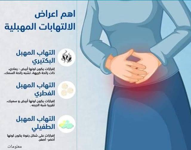 أسباب التهاب المهبل وأعراضه و علاج منزلى فعال من أول يوم