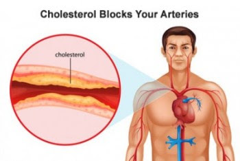 Reducing cholesterol naturally