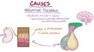 Some of the causes of Cushing syndrome Disease Pictures