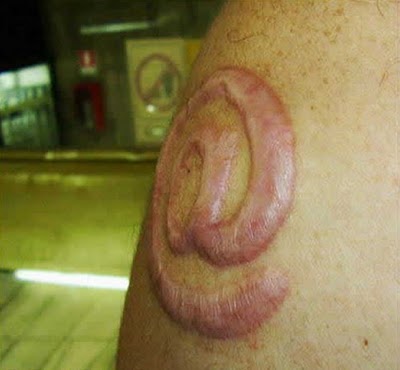 scarification tattoo. Awesome Scarification
