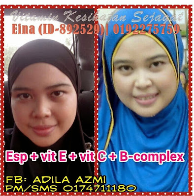 Testimoni Set Kulit Cantik Shaklee