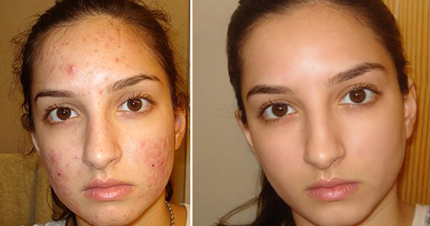This Women Washed Her Face 3 Days With Secret Ingredients, And Looking So Young! See What She Use!