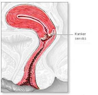 Treatment of cervical cancer