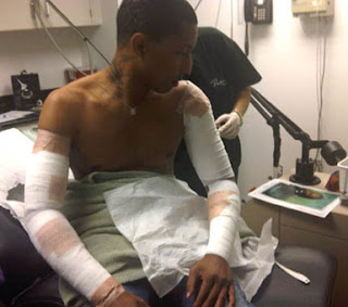 Pharrell williams gets tattoos removed hurt