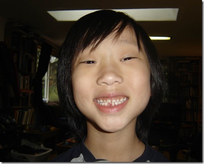 maxfirsttoothout