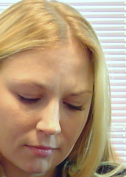 Stroke prevention with plavix cva bleed remedy