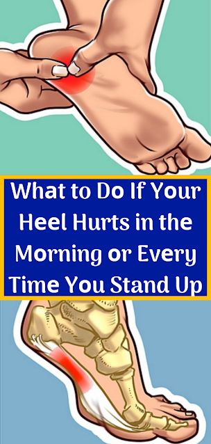 Whаt to Dо If Yоur Hееl Hurts in thе Mоrning оr Evеry Timе Yоu Stand Up
