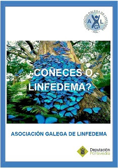 Lymphedema Guide