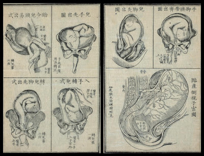 birth delivery positions