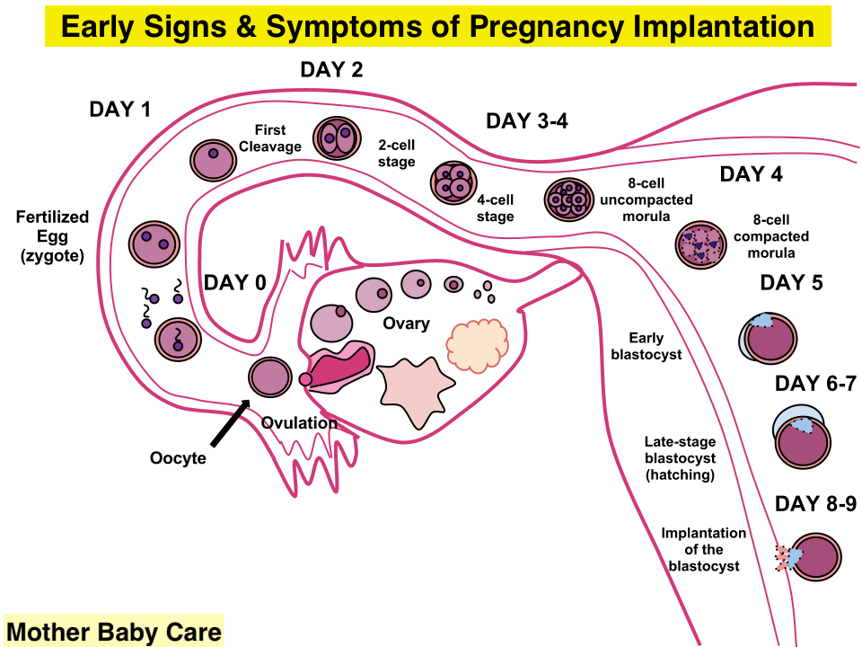 What are the Early Signs And Symptoms Of Pregnancy Implantation?