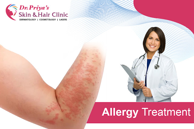 Best Allergy Treatment In Bangalore