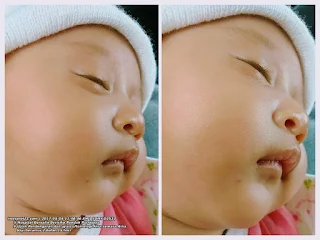 gambar Aina semasa masih bayi melalui ujian pendengaran