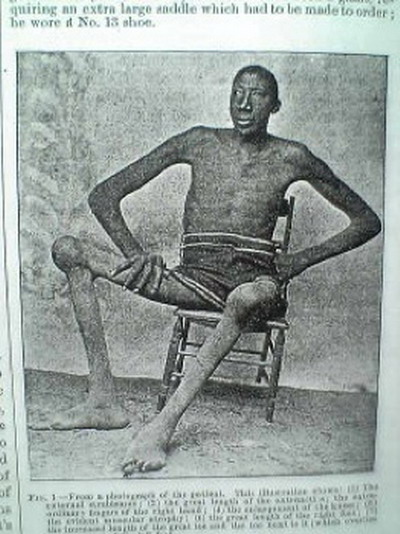 John Rogan (2,71 meter) John Rogan (2,71 meter)