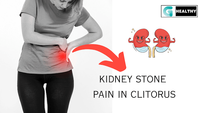 Managing Kidney Stone Pain in Clitoris