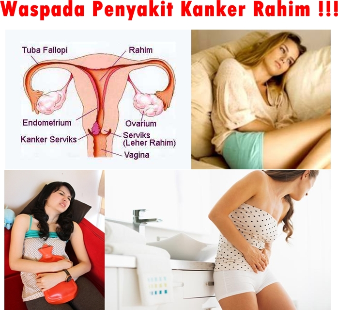 Pengobatan Tradisional Kanker Serviks