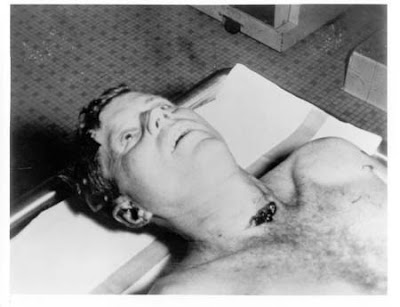 kennedy assassination autopsy pictures. assassination autopsy