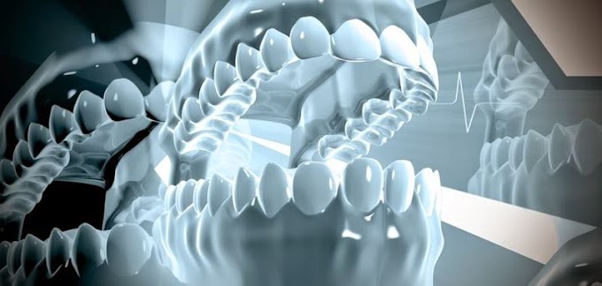 Impresión 3D en la odontología: ¿por qué las tecnologías 3D están revolucionando el sector? (Odontología)