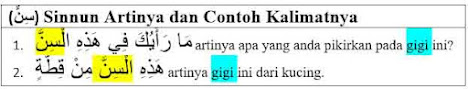 (سِنٌّ) Sinnun Artinya, Tashrif dan Contoh Kalimatnya