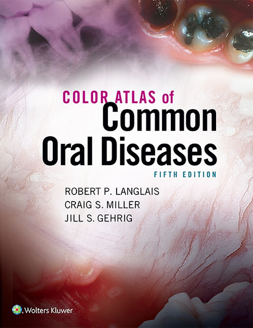 Color Atlas of Common Oral Diseases 5th Edition cover