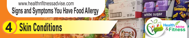 Food Allergy Strips04