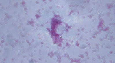Bakteri Salmonella Typhi