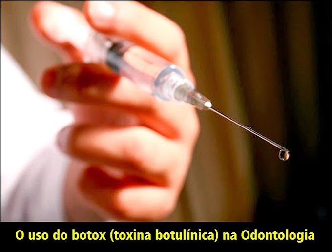 BOTOX: O uso do toxina botulínica na Odontologia