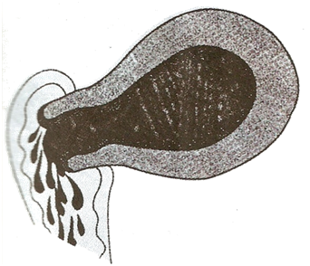 Ppgt jem ria: Abortus Ppgt jem ria: Abortus
