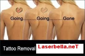 http://www.laserbella.net/